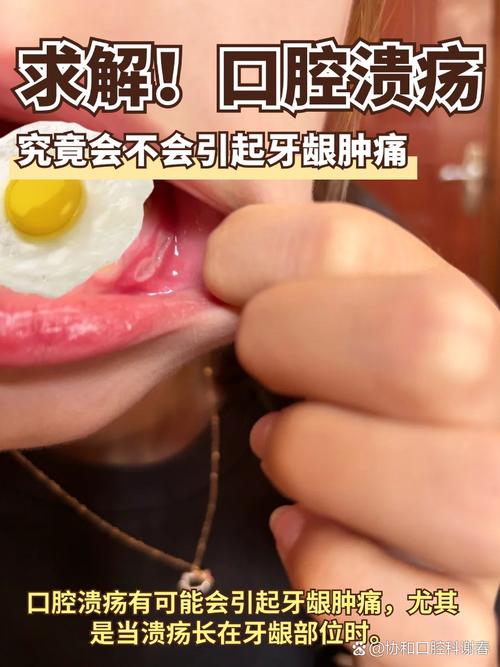 牙龈根部口腔溃疡为何频发难愈?