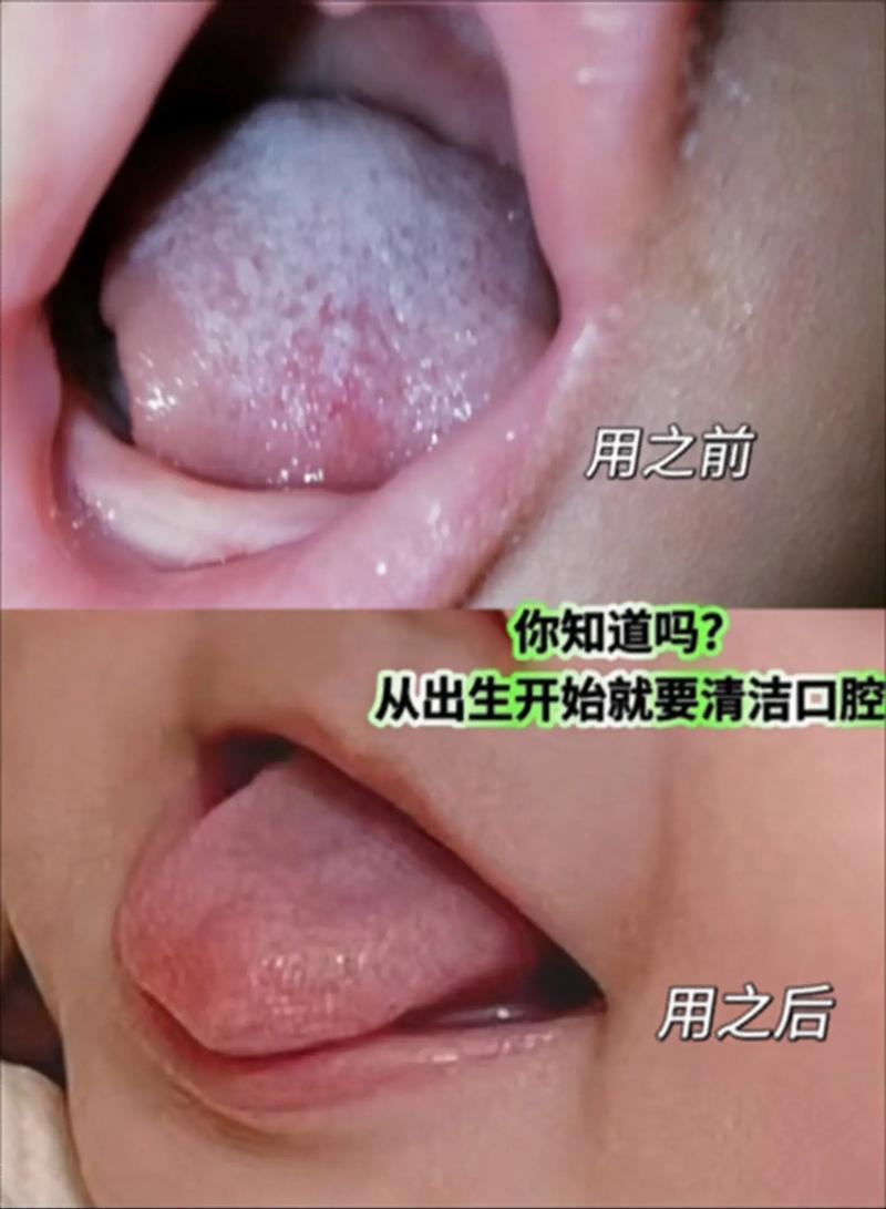 宝宝多大开始刷牙?护齿黄金期是几岁?