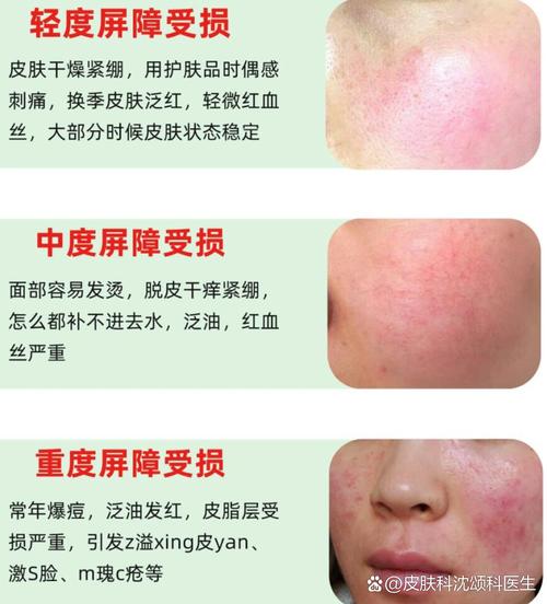 面部皮肤痒,是过敏还是疾病信号?