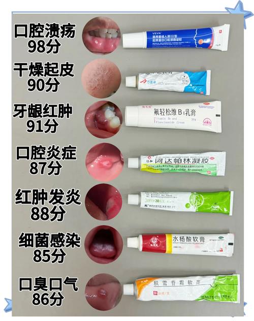 口腔溃疡吃益生菌到底有用吗?