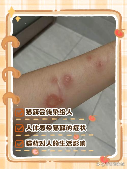 猫皮肤病会传染人吗?