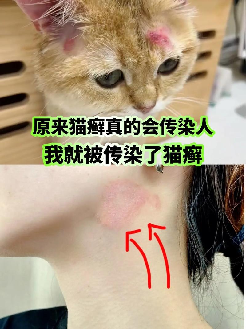 猫皮肤病会传染人吗?