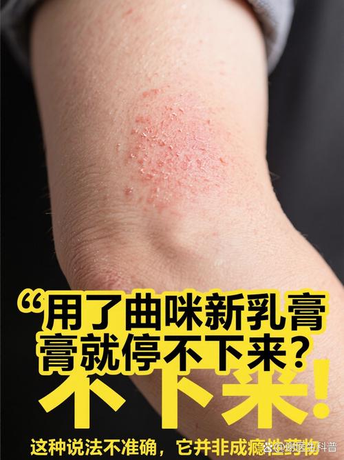 过期皮肤药到底能不能用?