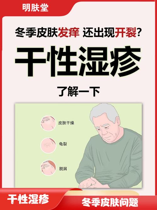 全身皮肤干痒,如何快速缓解?