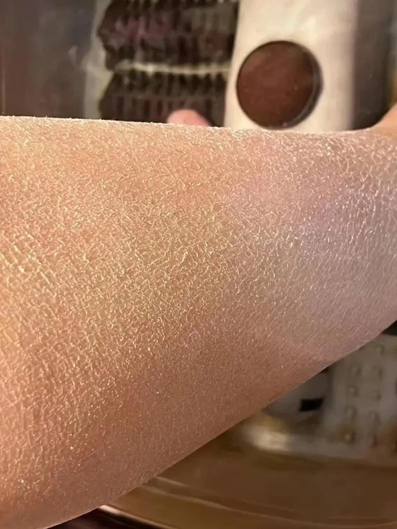 粗糙皮肤适合用什么护肤品?