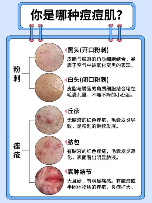脸部皮肤病种类多,图片如何辨别?