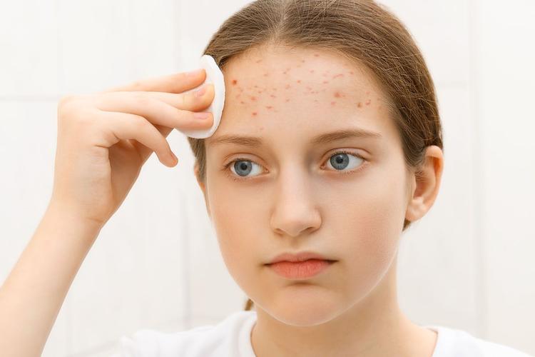 油性皮肤清水洗脸能控油吗?