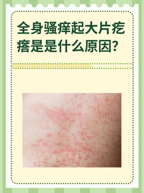 皮肤夜间发痒,是哪些疾病信号?