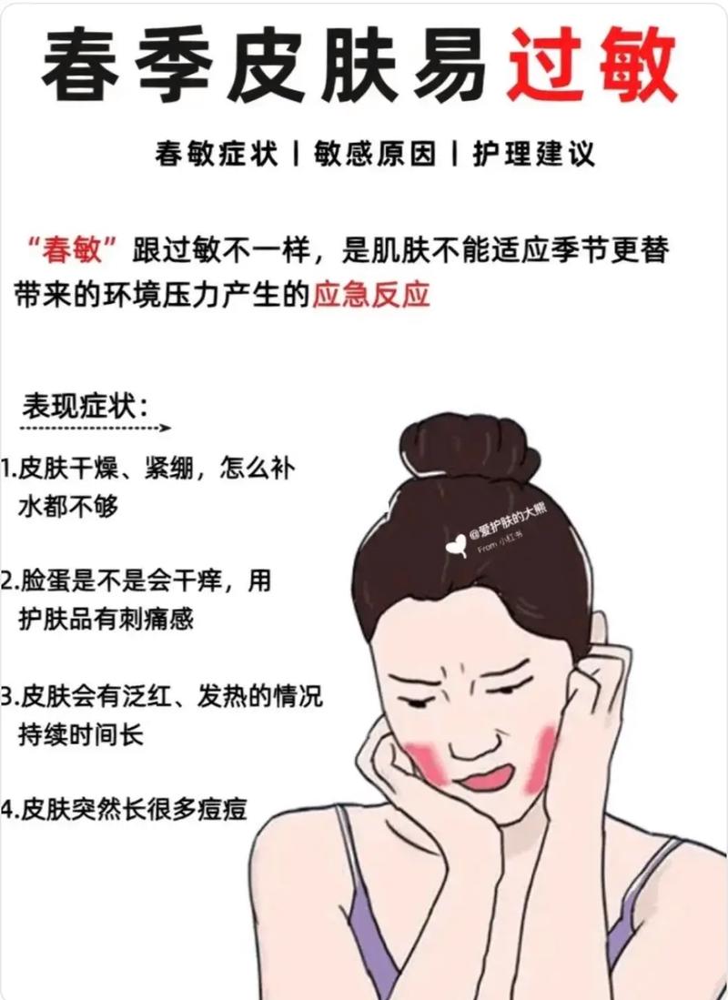 春季防皮肤过敏,关键做好这几步?