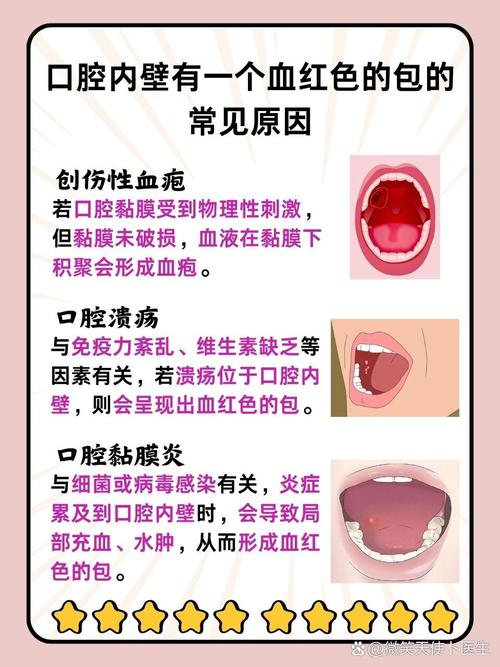 口腔易出血,是缺乏维生素还是疾病信号?