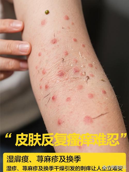 什么东西能快速止痒皮肤?