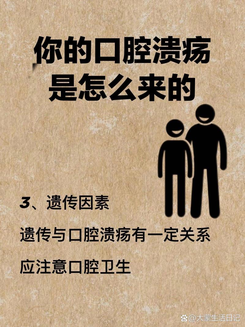 口腔溃疡如何快速愈合?