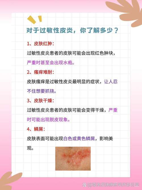 季节性皮肤过敏怎么治?关键在哪儿?