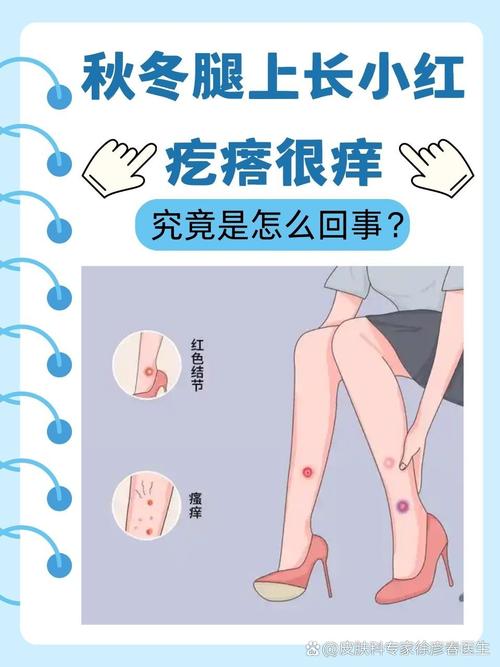 冬季皮肤干燥发痒,如何快速止痒保湿?