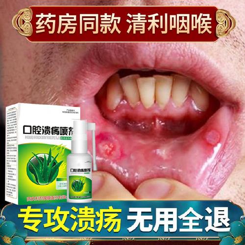 口腔溃疡喷雾哪个品牌最有效?