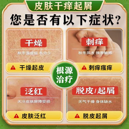 冬季皮肤痒,选什么药膏最有效?