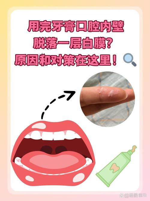 口腔内壁白点是什么原因引起的?