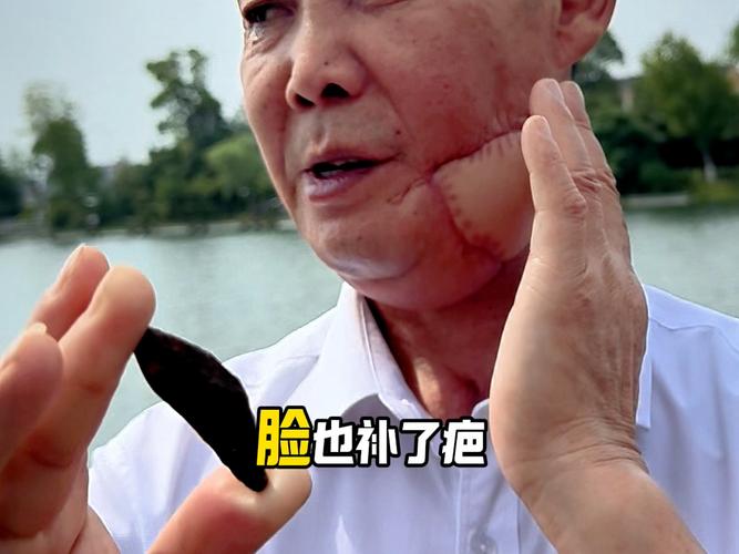 戒槟榔后口腔能恢复吗?