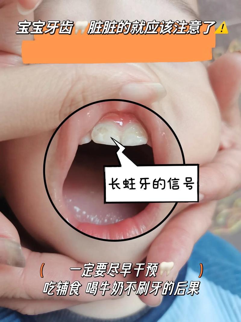 婴儿口腔异味是何原因导致的?