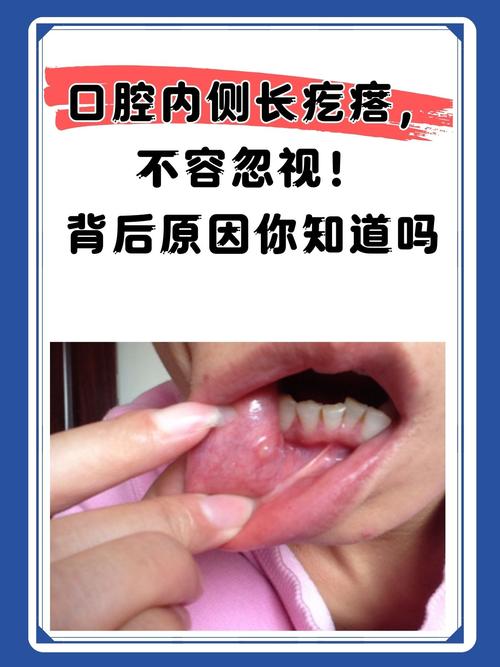 口腔有结节是什么症状