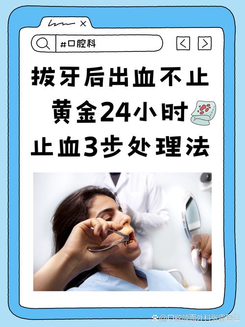 口腔出血怎么快速止血