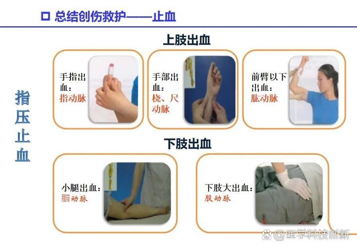 口腔出血怎么快速止血