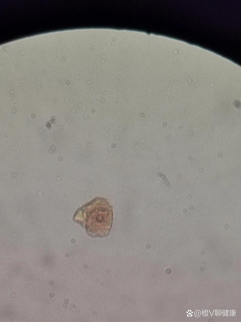 口腔黏膜细胞基因检测