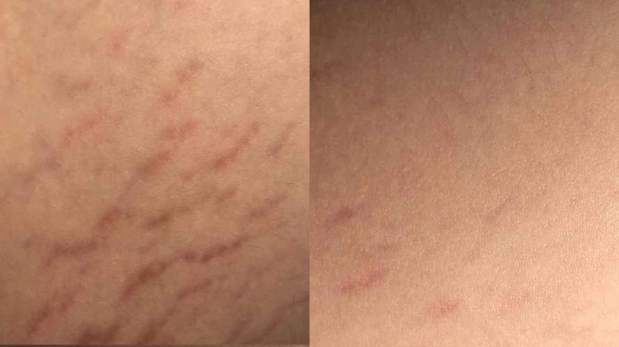 生完孩子皮肤会变好吗