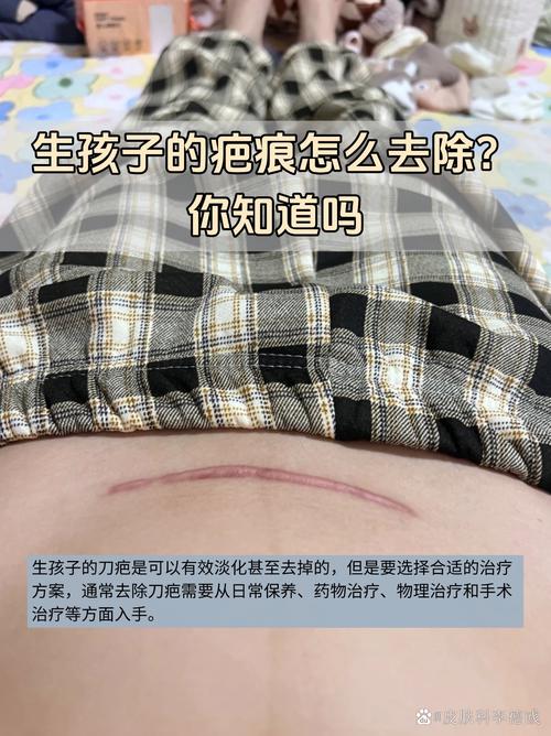 生完孩子皮肤会变好吗