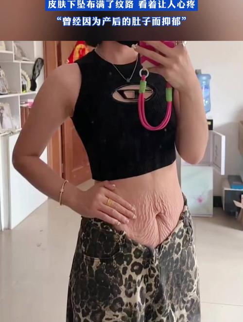 生完孩子皮肤会变好吗