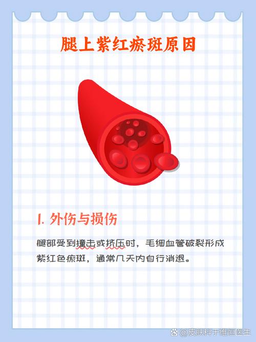 淤血为何会出现?皮肤淤血原因揭秘