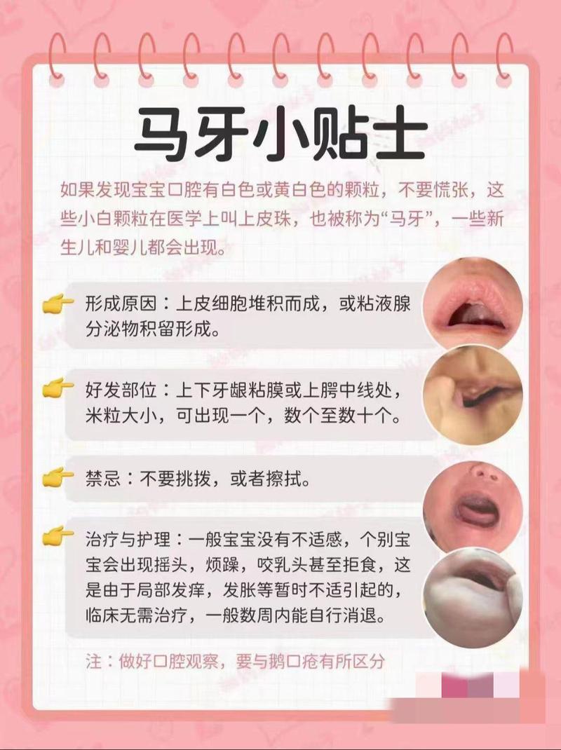 宝宝口腔内壁正常图片