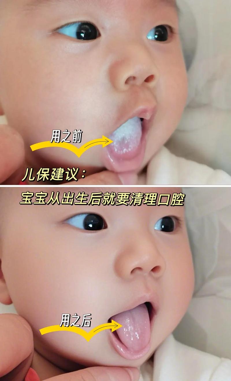 宝宝口腔内壁正常图片