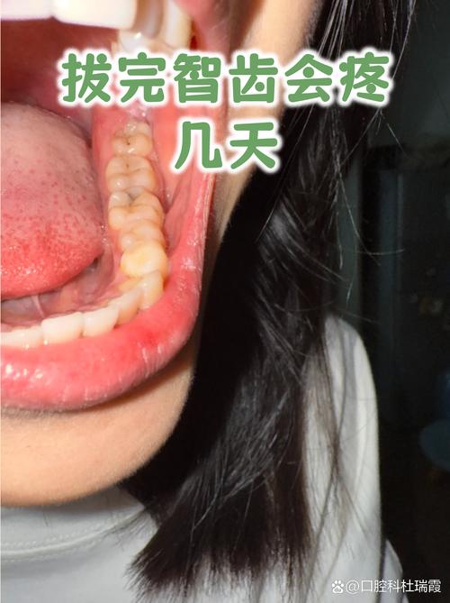 口腔伤口愈合到底要多久?