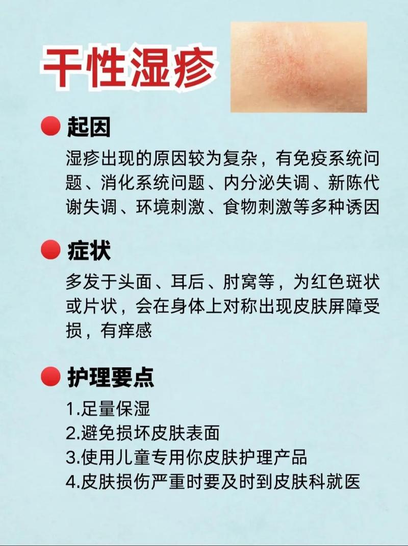 湿疹忌口清单有哪些?