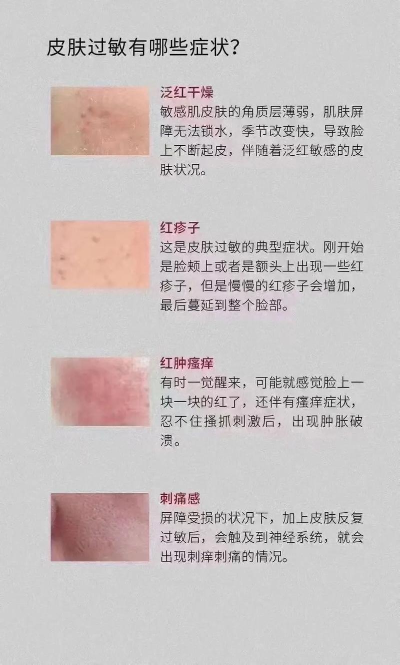 皮肤过敏瘙痒,怎么快速缓解?