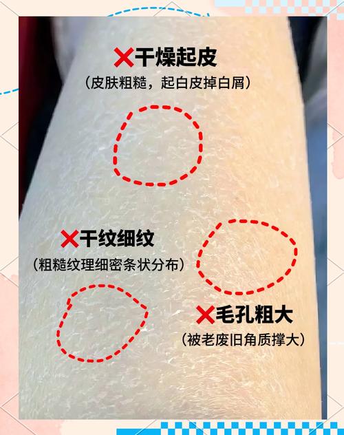 皮肤起皮快速解决,这3招管用吗?