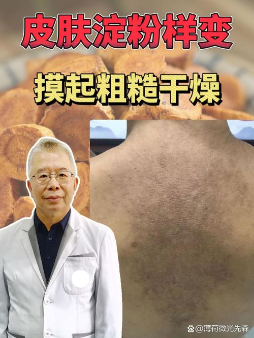 后背皮肤发黑粗糙是何原因?