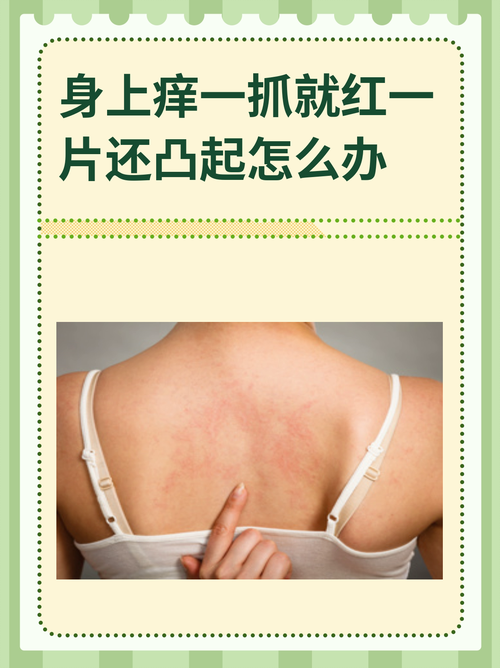 皮肤又红又痒怎么回事