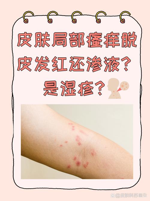 皮肤又红又痒怎么回事