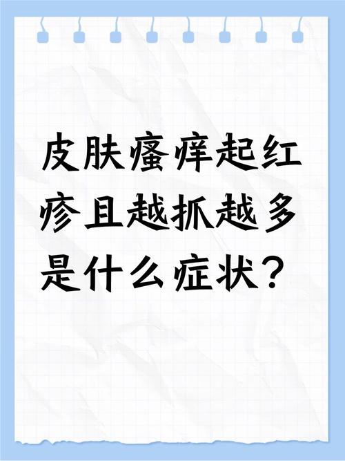 皮肤又红又痒怎么回事