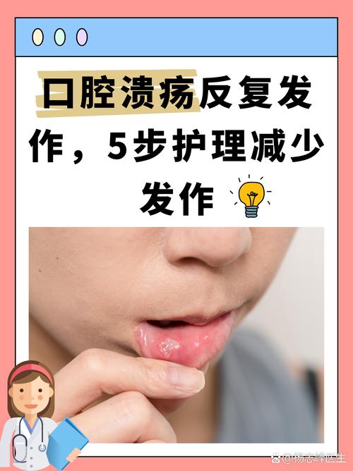 如何有效预防口腔溃疡反复发作?