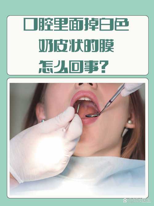 口腔黏膜脱落怎么快速修复?