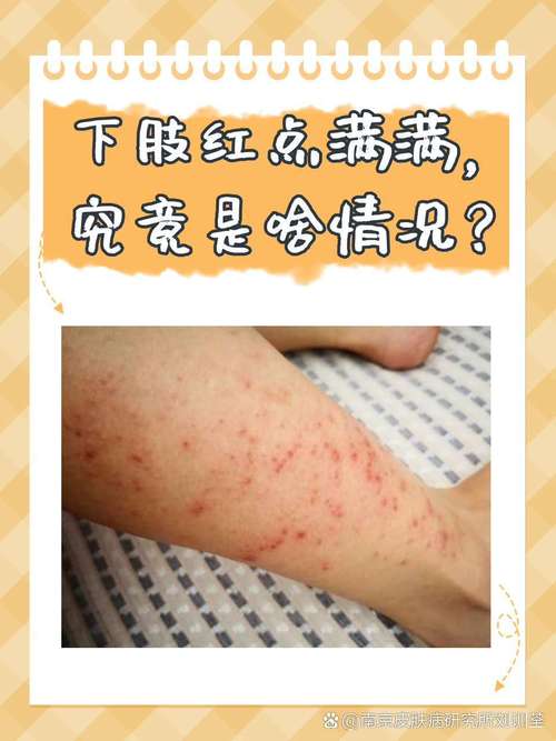 皮肤小红血点痒是过敏还是其他问题?