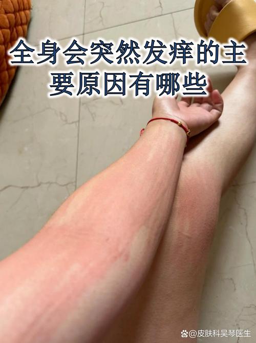 运动皮肤痒是怎么回事