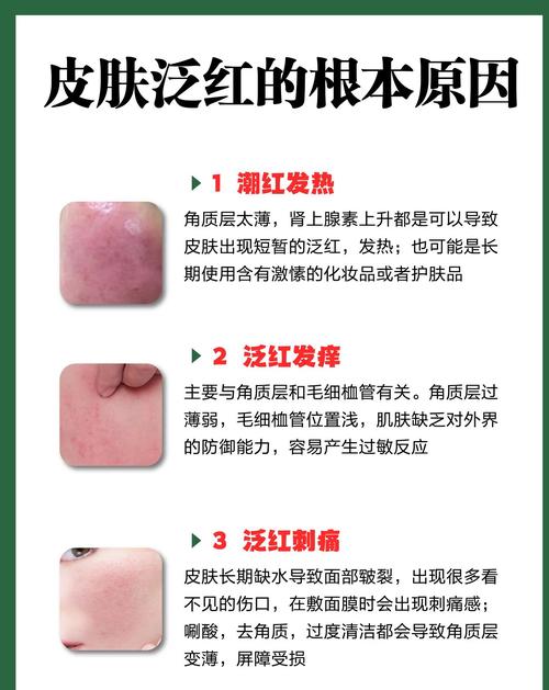 运动皮肤痒是怎么回事