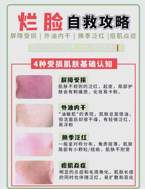 脸上皮肤过敏痒怎么快速缓解？